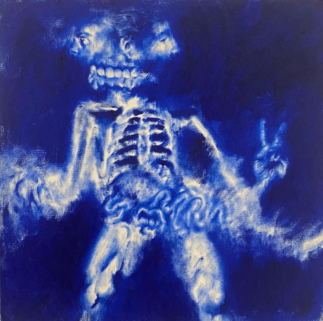 Radiografía